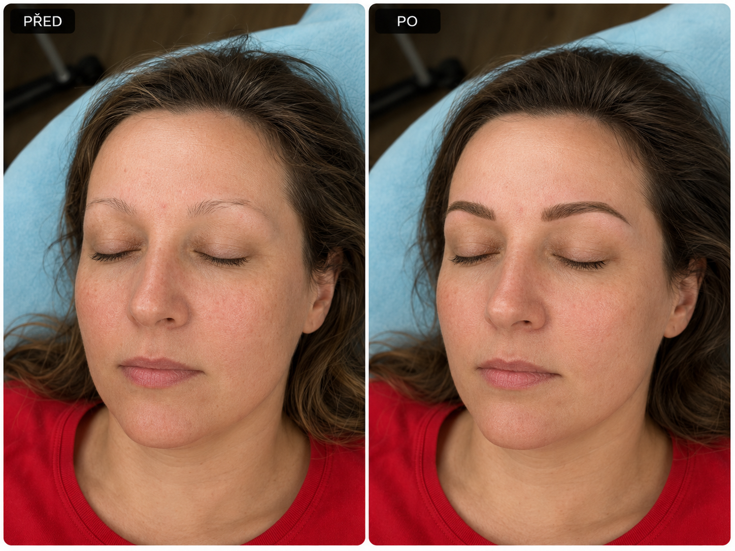 PMU obočí před a po 9